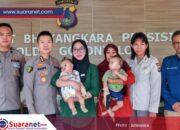 ‎Bakti Kesehatan Hari Bhayangkara ke-80, Polda Gorontalo Gelar Operasi Bibir Sumbing Gratis‎‎