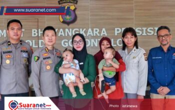 ‎Bakti Kesehatan Hari Bhayangkara ke-80, Polda Gorontalo Gelar Operasi Bibir Sumbing Gratis‎‎