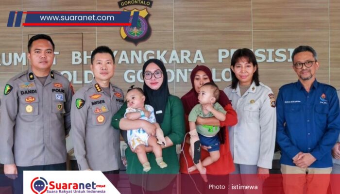 ‎Bakti Kesehatan Hari Bhayangkara ke-80, Polda Gorontalo Gelar Operasi Bibir Sumbing Gratis‎‎